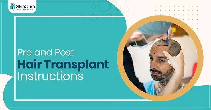 Essential Pre and Post Hair Transplant Instructions for Optimal Results - SkinQure, Delhi