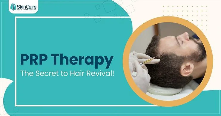 PRP Does The Cure For Hair Loss Lie Within Our Blood? - SkinQure, Delhi