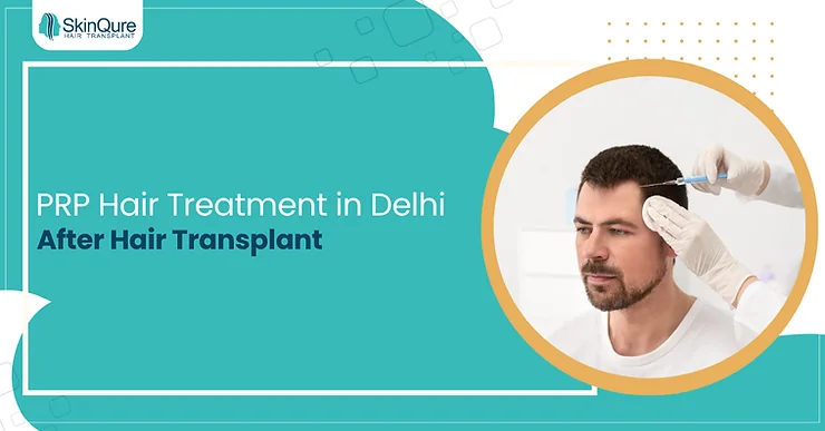 PRP Hair Treatment in Delhi After Hair Transplant - SkinQure, Delhi