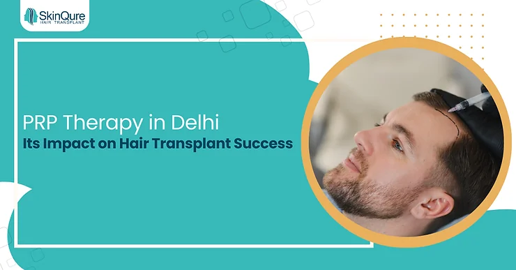 PRP Therapy in Delhi and Its Impact on Hair Transplant Success - SkinQure, Delhi