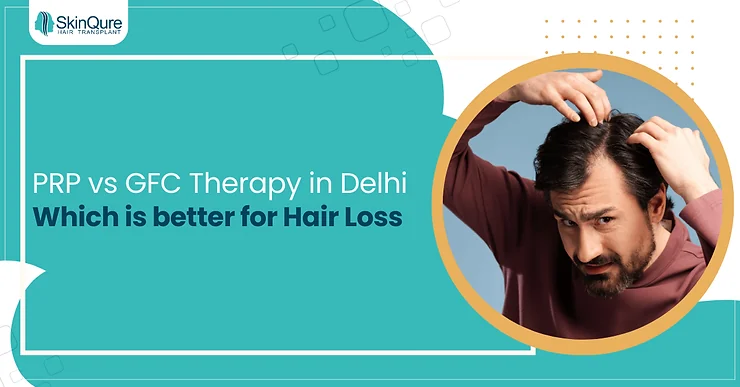 PRP vs GFC Therapy in Delhi: Which is better for hair loss - SkinQure, Delhi