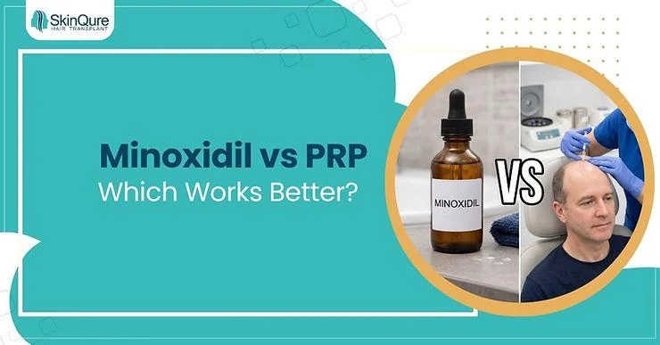 PRP vs Minoxidil for Hair Loss: Which Works Better? - SkinQure, Delhi