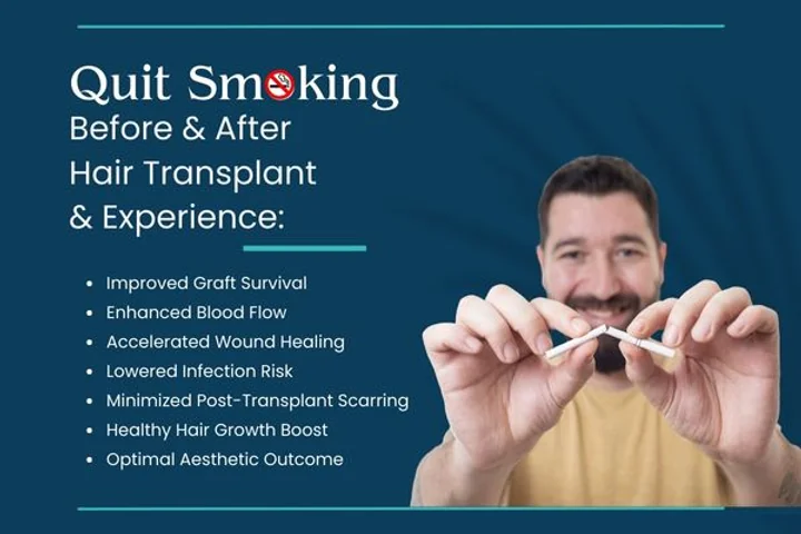 Quit smoking before and after hair transplant - improved graft survival, enhanced blood flow, accelerated wound healing, lowered infection risk, minimised post-transplant scarring, healthy hair growth boost, optimal aesthetic outcome
