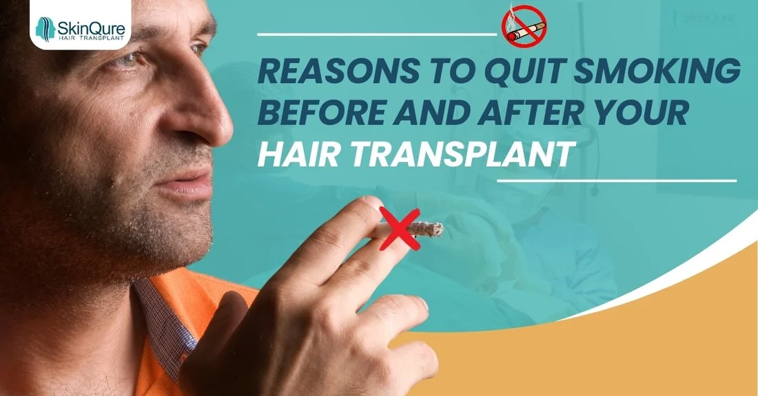 7 reasons to quit smoking before and after your hair transplant - SkinQure, Delhi