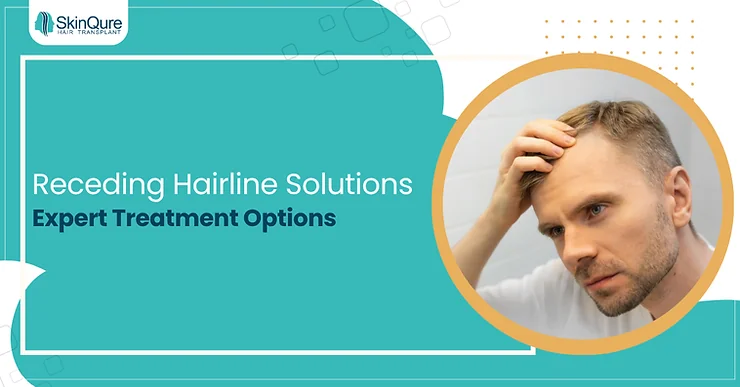Receding Hairline Solutions: Expert Treatment Options - SkinQure, Delhi