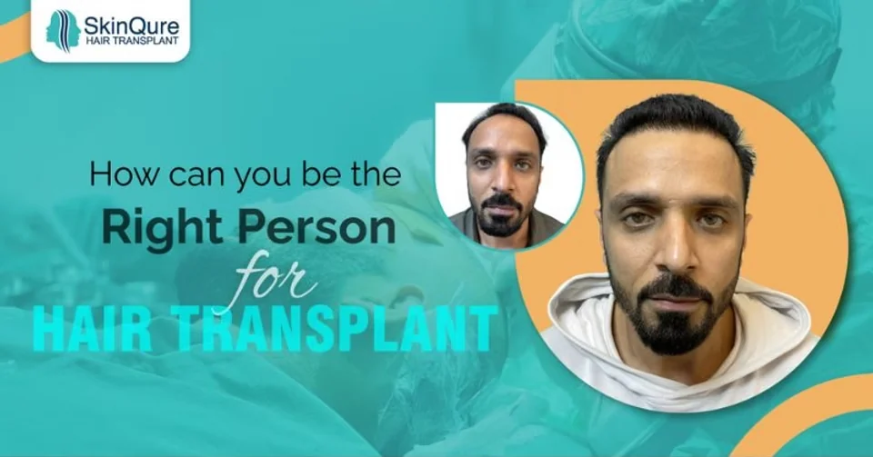 How can you be the right person for a hair transplant - SkinQure, Delhi