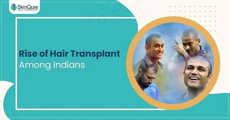 Rise of hair transplants among Indians - SkinQure, Delhi