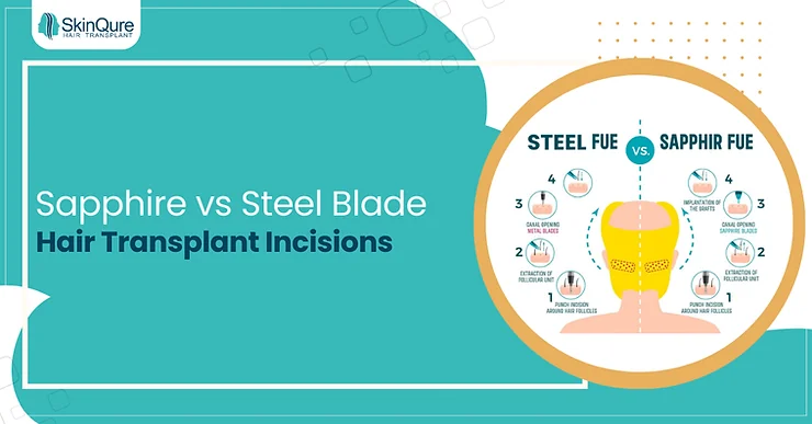 Sapphire Hair Transplant vs Steel Blade Incisions - SkinQure, Delhi