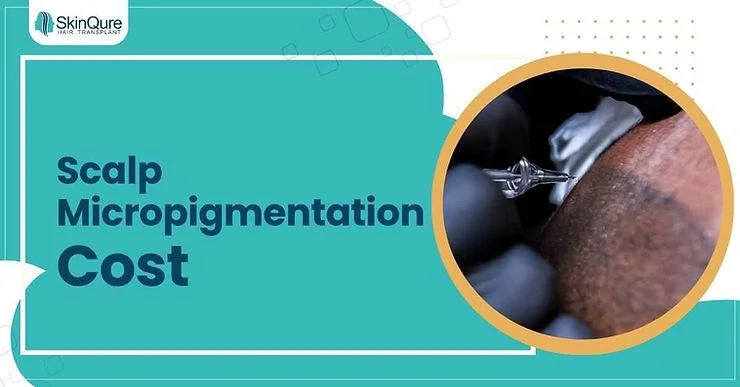 Scalp Micropigmentation Cost in Delhi: Full Guide - SkinQure, Delhi