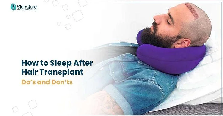 How to Sleep After Hair Transplant: Do’s and Don’ts - SkinQure, Delhi