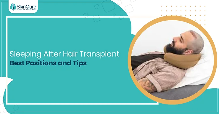 Sleeping After Hair Transplant: Best Positions and Tips - SkinQure, Delhi
