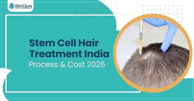 Stem Cell Hair Treatment India: Process & Cost 2026 - SkinQure, Delhi