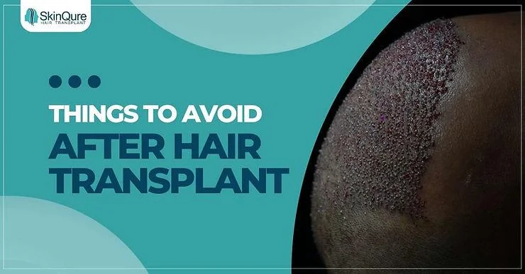 Things to Avoid After a Hair Transplant - SkinQure, Delhi