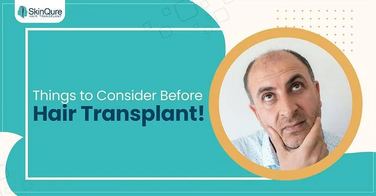 Things to Consider Before Getting a Hair Transplant - SkinQure, Delhi