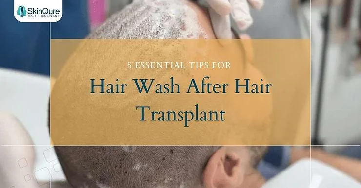 5 Essential Tips for Hair Wash After Hair Transplant - SkinQure, Delhi