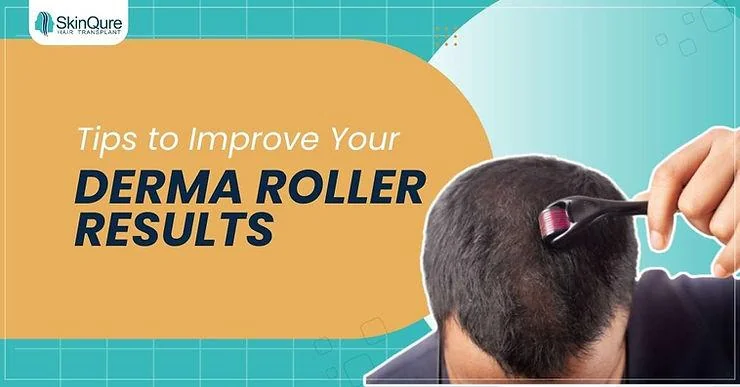 Tips to Improve Your Derma Roller Results - SkinQure, Delhi