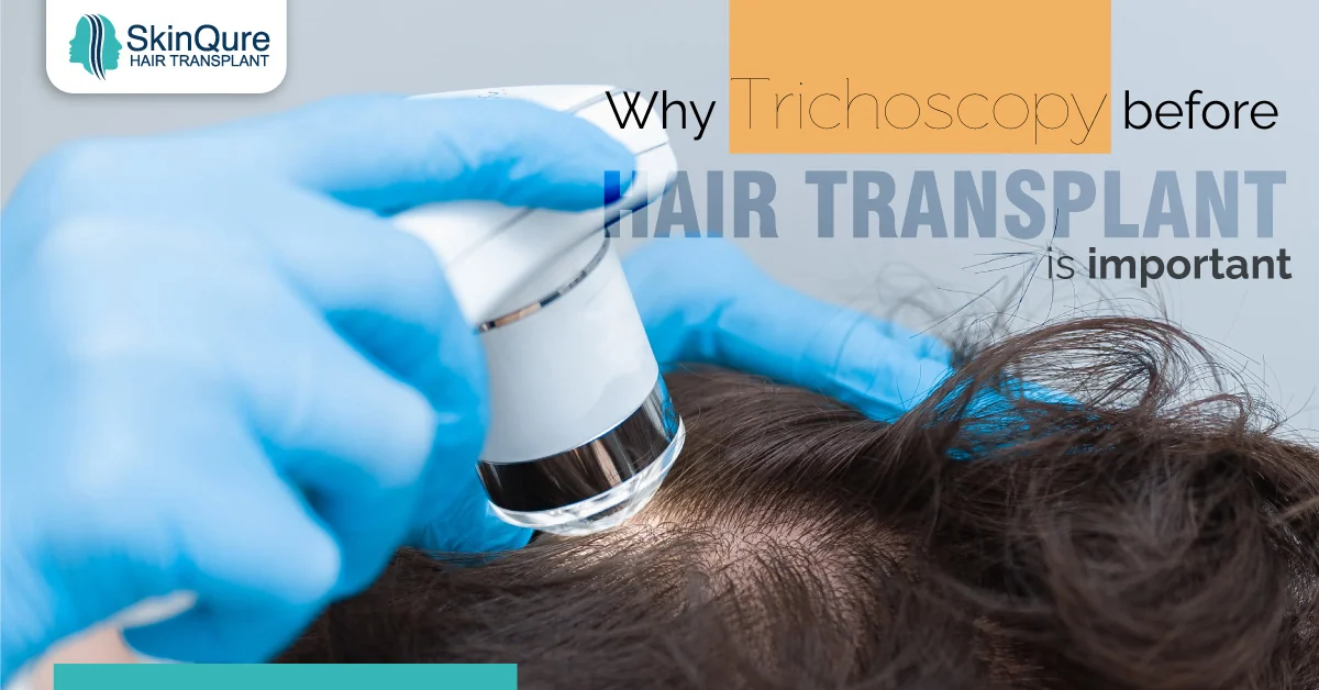Trichoscopy before hair transplant - why it is important - SkinQure, Delhi