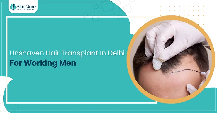 Unshaven Hair Transplant In Delhi For Working Men - SkinQure, Delhi