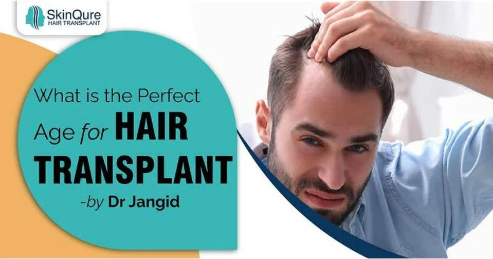 What is the perfect age for hair transplant - by Dr Jangid, SkinQure, Delhi