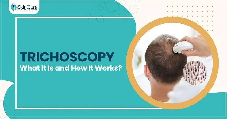 What is Trichoscopy and How Does Trichoscopy Work? - SkinQure, Delhi