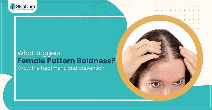 What Triggers Female Pattern Baldness? Treatment & Preventions - SkinQure, Delhi