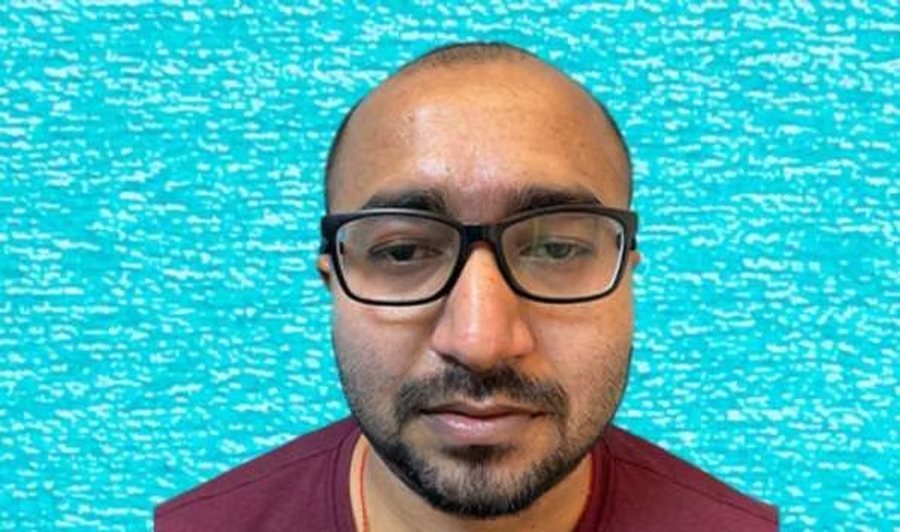 33-year-old male patient at his first hair loss consultation at SkinQure, Delhi