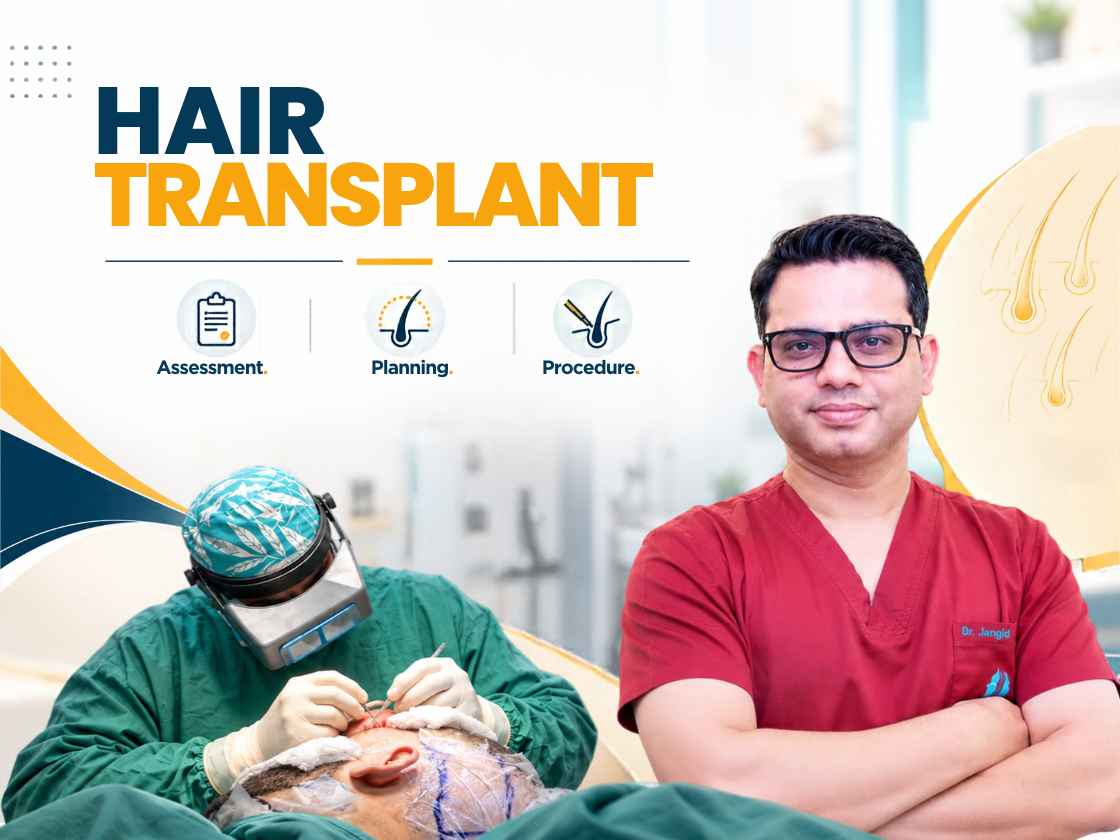Dr. Jangid performing a hair transplant at SkinQure clinic, Delhi
